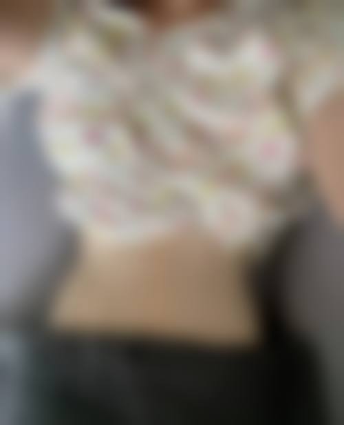 臀部吸脂减肥疼吗——斯楼斌医生所在医院