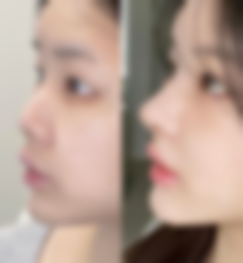 佛山爱博恩妇产医院口碑好不好？附真实患者口碑评价