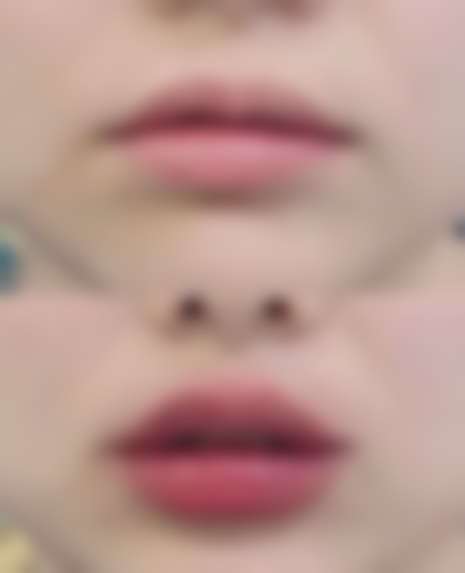 四、3岁小孩脸上外伤疤痕慢慢修复的关键要点