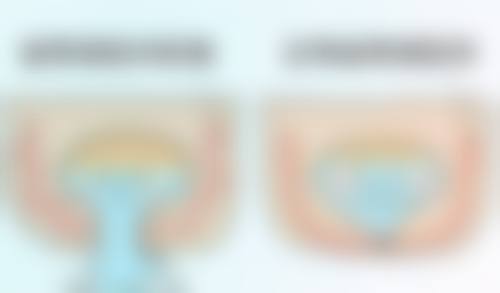 怎么除顽固的眼袋——天津南开紫洁医疗美容门诊部