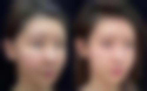 西安卢丙仑奥斯卡整形美容门诊部怎么样