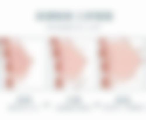 长痘痘留的疤痕怎么去除：手术祛疤，极端情况的解决之道