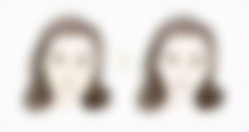 半肋骨隆鼻子是恒久的吗之恒久定型的可能性