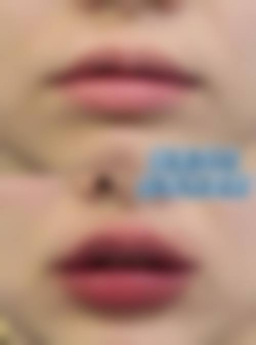 长沙壹希光合整形医院真实患者口碑评价