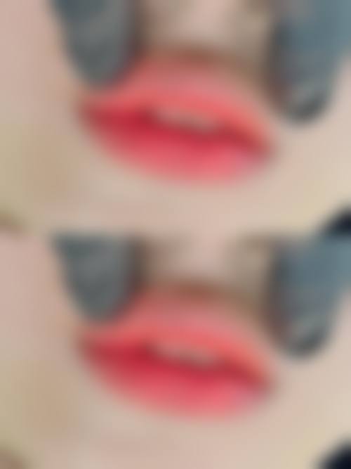 四川汉密尔顿医疗美容医院价格表