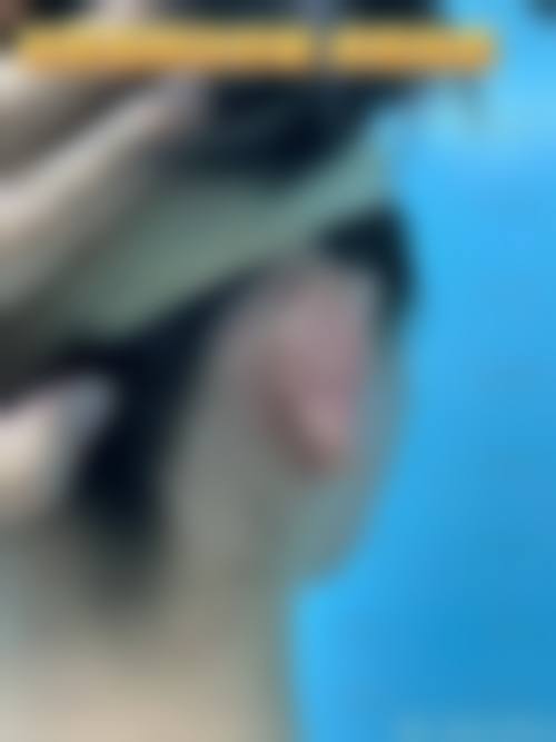 无锡市港务医院整形科价格表