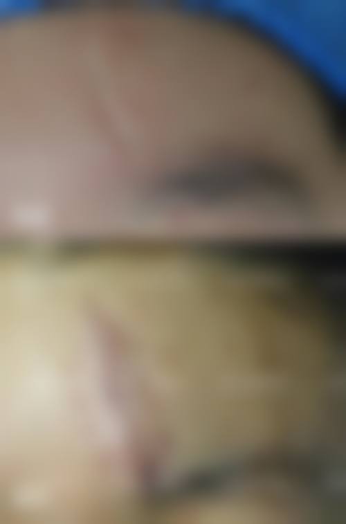 山东佰瑞德美容医院项目特色