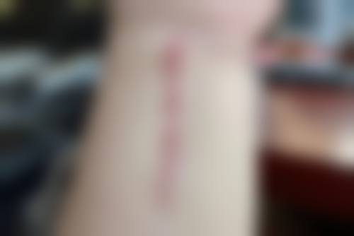 上海沪申五官整形医院价格表