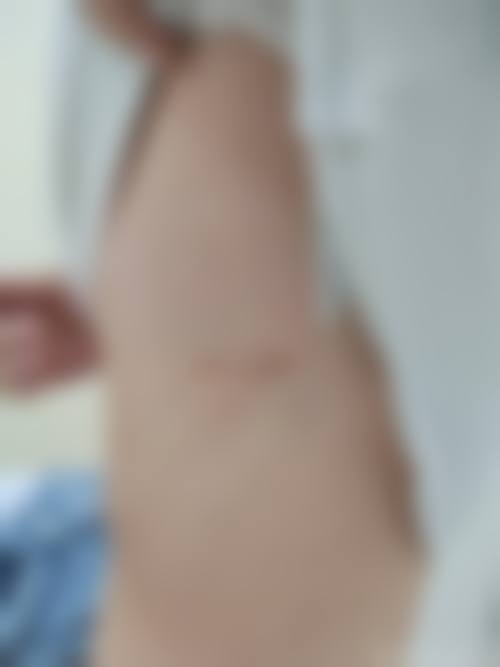 龙岩欧菲整形医院项目特色