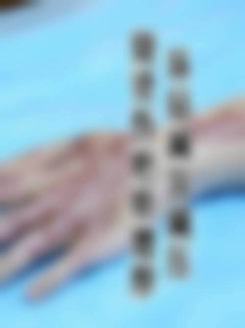 四、宜宾市第一人民医院整形烧伤科怎么样——项目特色