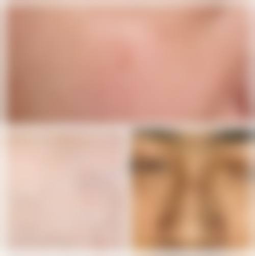 长沙微密整形美容医生水平怎么样