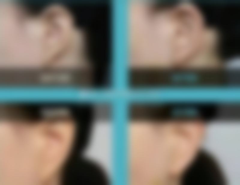 四川汉密尔顿医疗美容医院口碑好不好？附真实患者口碑评价