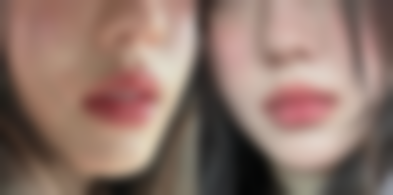 长痘痘留的疤痕怎么去除：中医祛疤秘方，千年智慧显成效