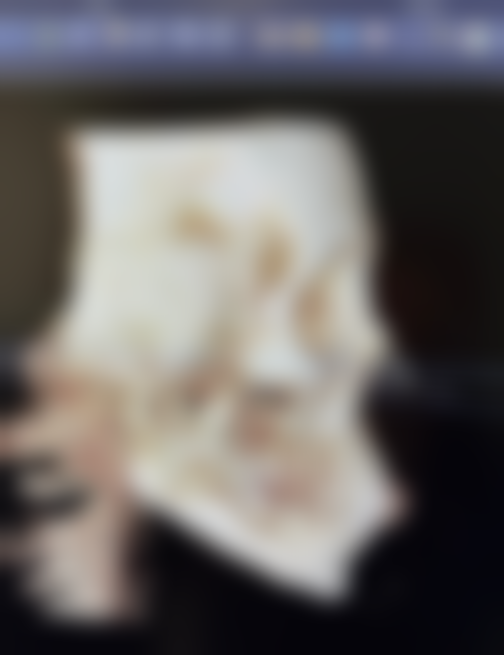 做眼袋手术什么年龄合适——特殊人群注意事项