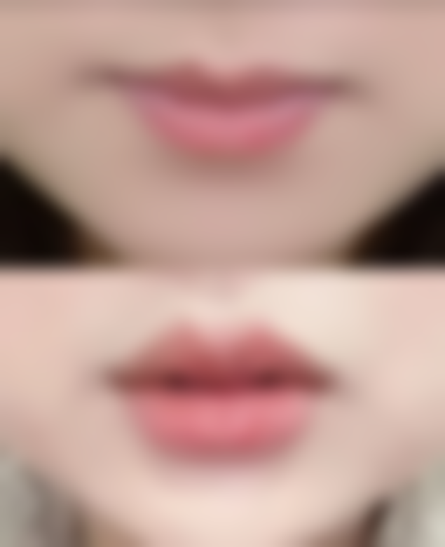 黑眼圈黑眼袋怎么去——韩国大眼睛整形医院