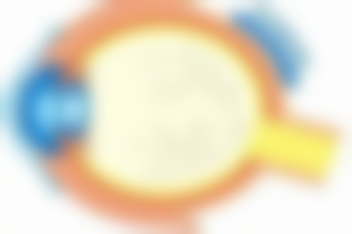 隆胸假体取出会引发感染风险吗