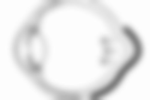 隆鼻25天可以吃海鲜吗？术后恢复期吃海鲜会发炎留疤吗？医生建议这样吃