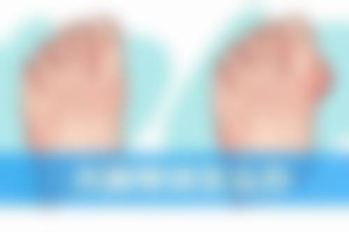 怎么判定自己是不是疤痕体质之追溯家族史：探寻基因的“神秘礼物”