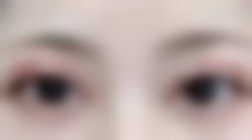 隆鼻25天海鲜食用指南：医生科学建议