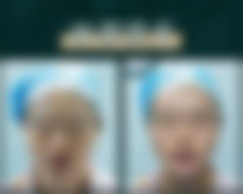 广州高尚医学美容中 心景丽峰美学定制方案手术成效呈现