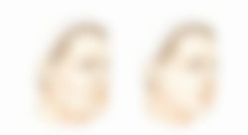 怎么判定自己是不是疤痕体质之观察症状表现：倾听皮肤的“抗议”