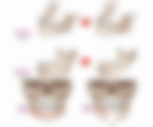 怎么判定自己是不是疤痕体质之诊断标准：明确判断要点