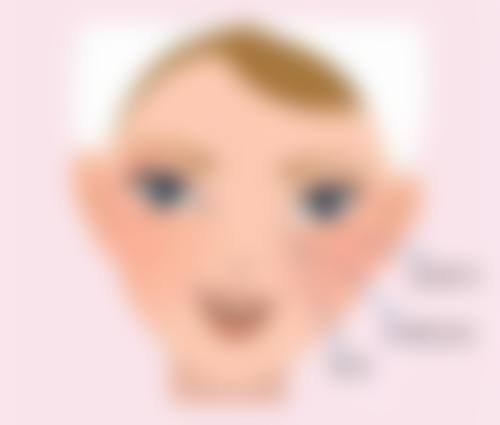 隆鼻25天：比海鲜更重要的术后护理要点