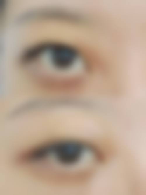 头发种植究竟好不好——武汉植发