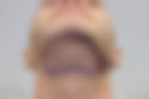 呼和浩特维科美容整形诊所更擅长什么手术