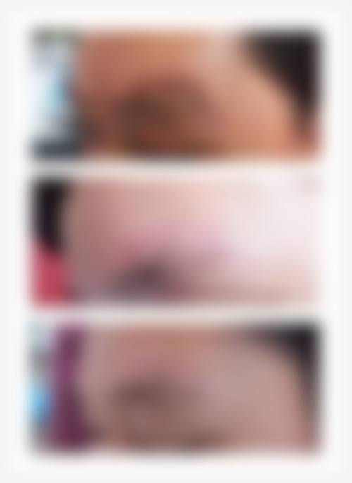 常州市第七人民医院烧伤整形科:经验多的手术伤口疤痕增生治疗科室