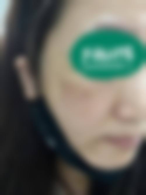 大理吴氏嘉美整形医院价格表:合理收费标准