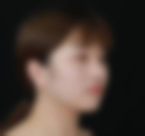 隆鼻整形后假体透光怎么办——重庆美仑美奂医疗美容策略