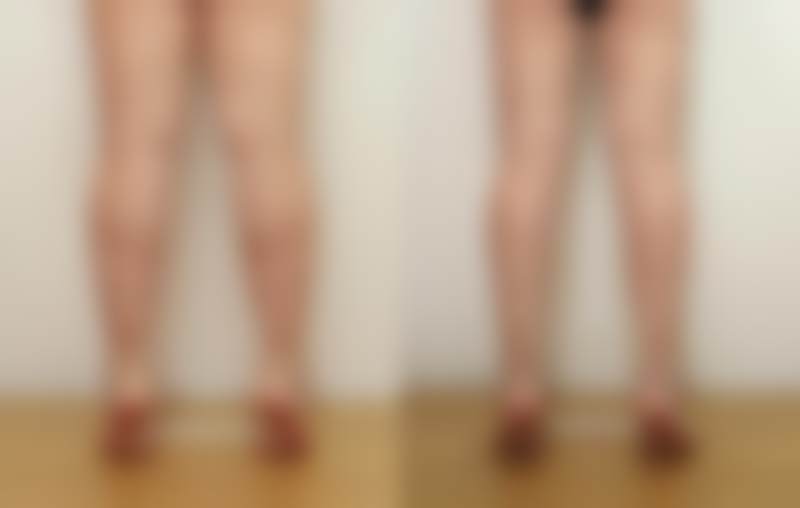 李敬秀医生口碑如何