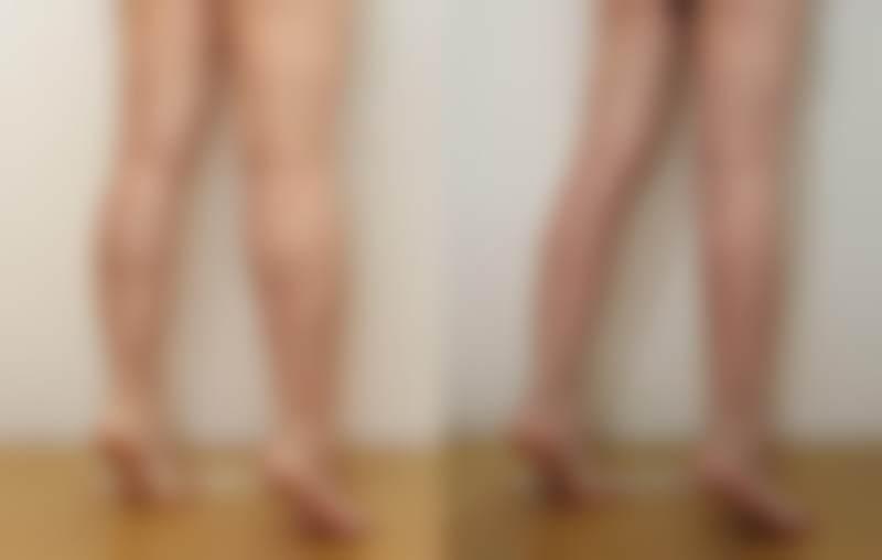 李敬秀医生顾客实例图片