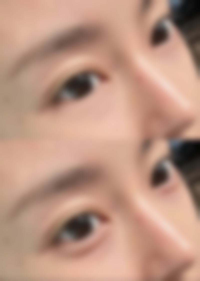 打了瘦脸针多久反弹——李海东医生所在医院