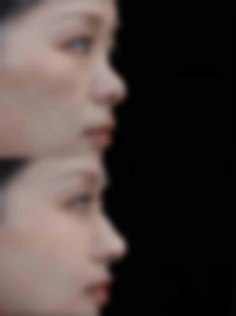 徐州睢宁速青春医美上班时间及地址