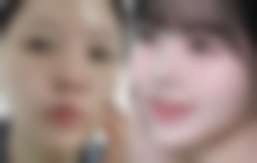 怎么样可以变成双眼皮呢——广州新市医院