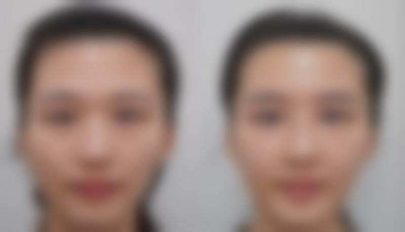 怎样去除眼袋和鱼尾纹：5个自然疗法温和改善眼周问题