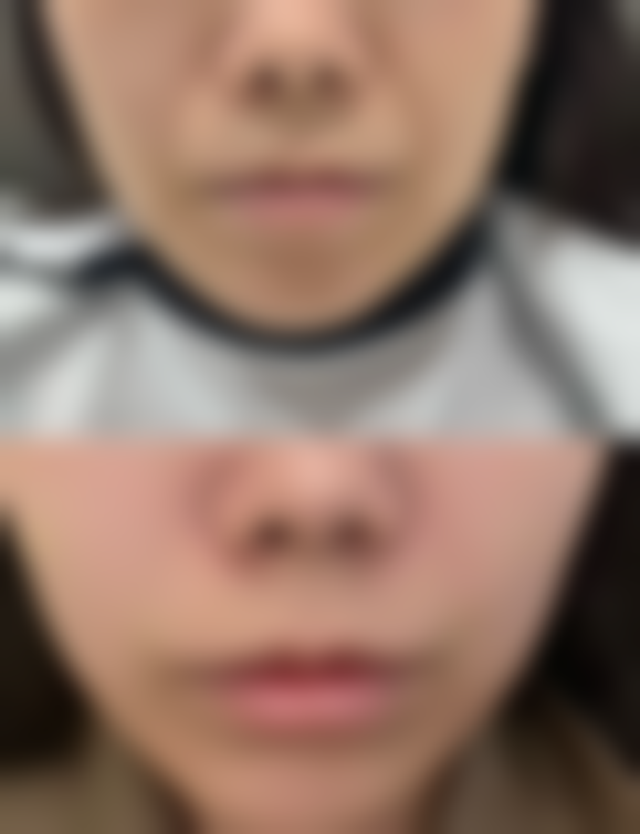 武警四川总队医院项目特色