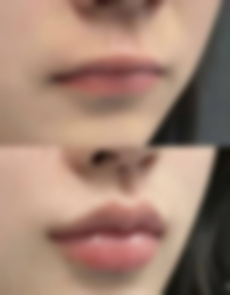 沈阳医学校沈洲医院整形美容科口碑好不好？附真实患者口碑评价