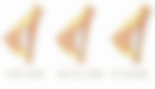 内双割双眼皮之北京华悦府医疗美容医院