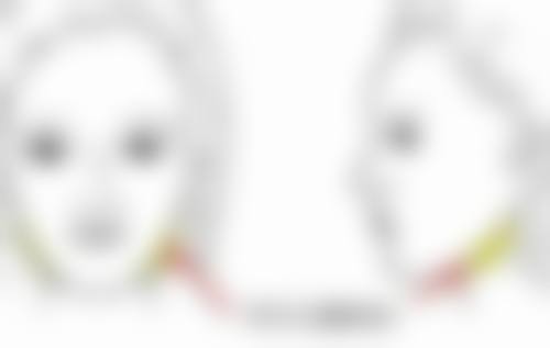 三、上海医院假体隆胸优势与关键要点