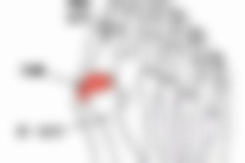 激光 + 手术双效修复方案深度解析