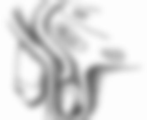 隆鼻修复包膜吸收症状早发现