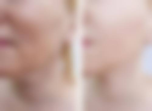 医院选择大PK：三等甲医院VS连锁医美