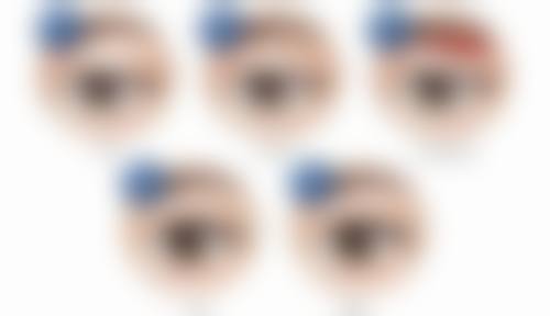 隆鼻修复包膜吸收时间揭秘