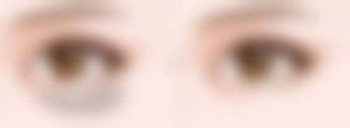 内双割双眼皮之郑州市第一人民医院整形外科