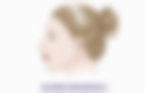 双眼皮手术拆线3天后碰水：优势与个性化建议