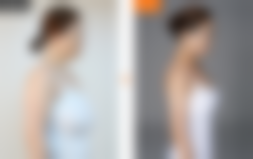 做假体隆胸有没有风险——厦门安黛美医疗整形美容