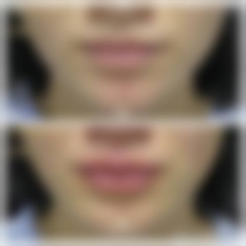 宜春西子奥拉克医疗美容门诊部价格表